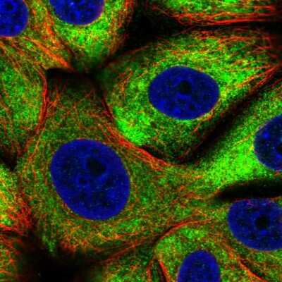 Immunocytochemistry/ Immunofluorescence: eIF4B Antibody [NBP2-33284]