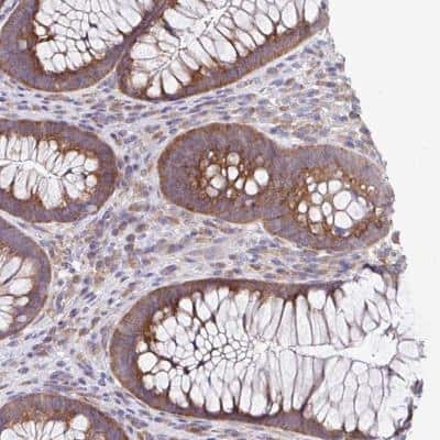 Immunohistochemistry-Paraffin: eIF4B Antibody [NBP2-33284]