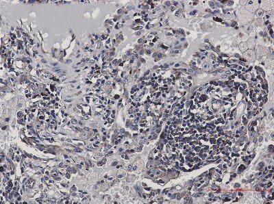 Immunohistochemistry-Paraffin: eIF4B Antibody (S07-2H2) [NBP3-19859]