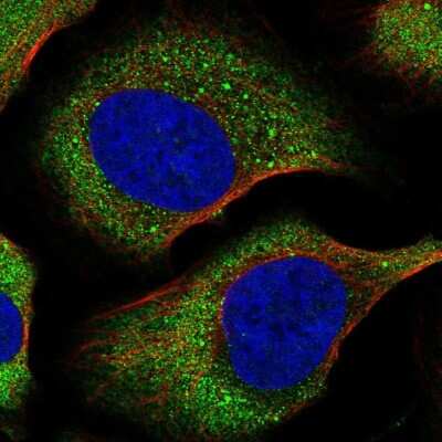 Immunocytochemistry/ Immunofluorescence: eIF4E Antibody [NBP2-57098]