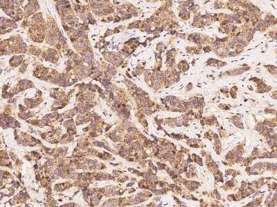 Immunohistochemistry-Paraffin: eIF4E Antibody [NBP2-98867]