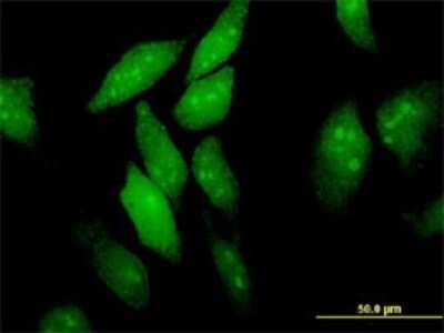 Immunocytochemistry/ Immunofluorescence: eIF4ENIF1 Antibody (2C4) [H00056478-M01]