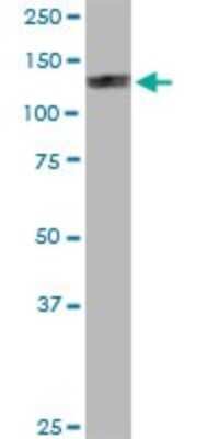 Western Blot: eIF4ENIF1 Antibody [H00056478-B01P]