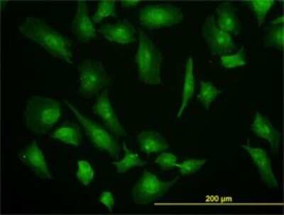 Immunocytochemistry/ Immunofluorescence: eIF4G1 Antibody (2A9) [H00001981-M10]