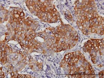 Immunohistochemistry-Paraffin: eIF4GII Antibody (1H5) [H00008672-M03]