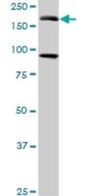 Western Blot: eIF4GII Antibody (1H5) [H00008672-M03]