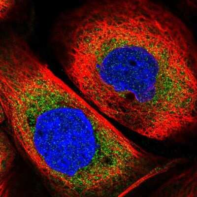 Immunocytochemistry/ Immunofluorescence: eIF4GII Antibody [NBP1-84867]