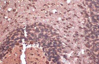 Immunohistochemistry-Paraffin: eIF4GII Antibody [NBP2-16309]