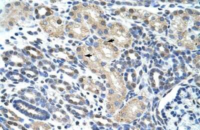 Immunohistochemistry-Paraffin: eIF4H Antibody [NBP1-57248]