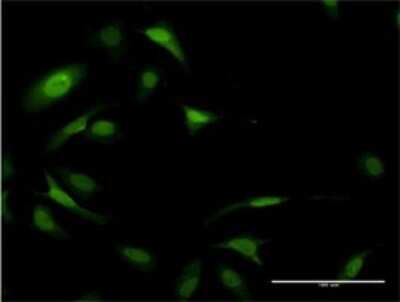 Immunocytochemistry/ Immunofluorescence: eIF5A Antibody (8C1) [H00001984-M01]