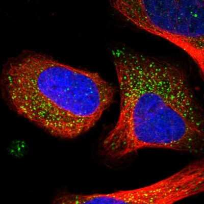 Immunocytochemistry/ Immunofluorescence: eIF5A2 Antibody [NBP1-85943]