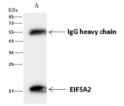 Immunoprecipitation: eIF5A2 Antibody [NBP2-96987]
