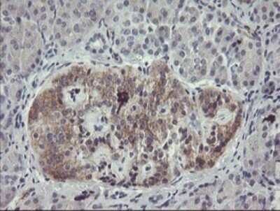 Immunohistochemistry: eIF5A2 Antibody (OTI6G7) [NBP2-45697]