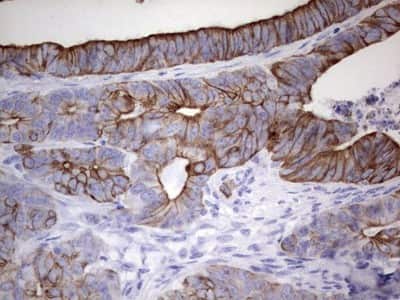Immunohistochemistry: enkurin Antibody (OTI6C10) [NBP2-45428]