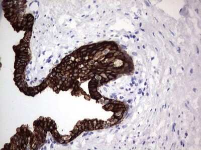 Immunohistochemistry: enkurin Antibody (OTI6C10) [NBP2-45428]