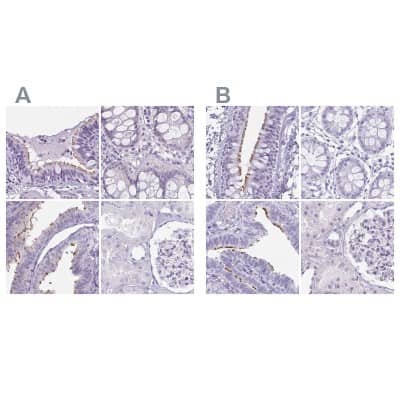 Immunohistochemistry-Paraffin: enkurin Antibody [NBP2-34037]