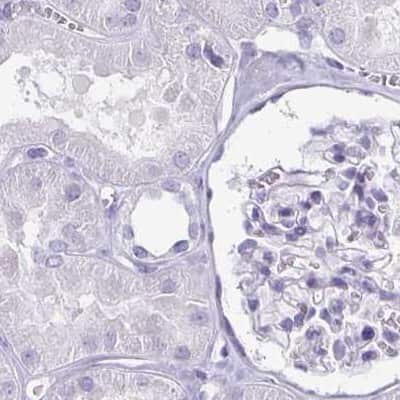 Immunohistochemistry-Paraffin: enkurin Antibody [NBP2-34037]