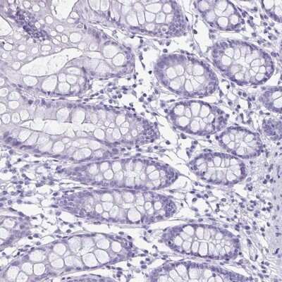 Immunohistochemistry-Paraffin: enkurin Antibody [NBP2-38925]