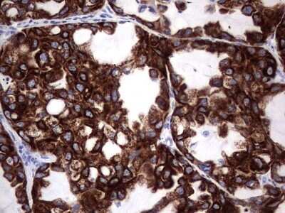 Immunohistochemistry: enkurin Antibody (OTI6C10) - Azide and BSA Free [NBP2-72461]