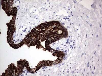 Immunohistochemistry: enkurin Antibody (OTI6C10) - Azide and BSA Free [NBP2-72461]