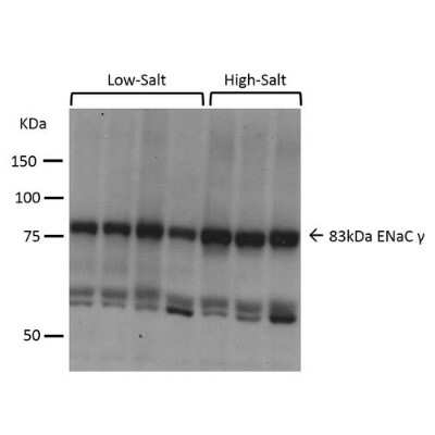 Western Blot: epithelial Sodium Channel gamma Antibody [NBP3-18256]