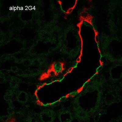 Immunohistochemistry: epithelial Sodium Channel alpha Antibody (2G4) [NBP2-59382]