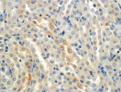 Immunohistochemistry: epithelial Sodium Channel alpha Antibody (2G4) [NBP2-59382]
