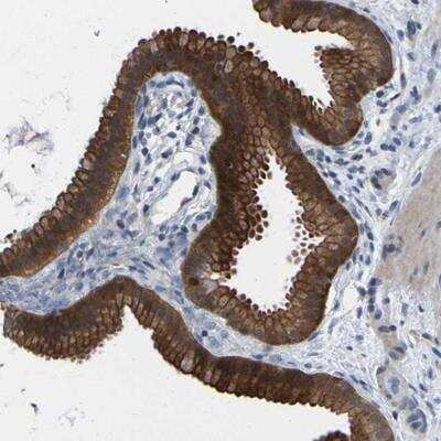 Immunohistochemistry-Paraffin: epithelial Sodium Channel alpha Antibody [NBP1-84846]