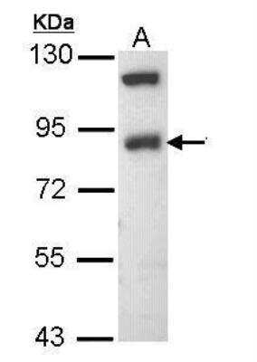 Western Blot: epithelial Sodium Channel beta Antibody [NBP1-33097]