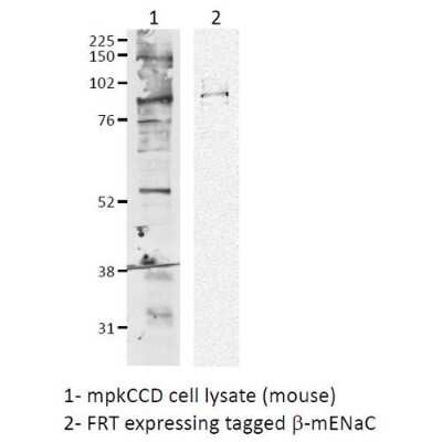 Western Blot: epithelial Sodium Channel beta Antibody [NBP3-18257]