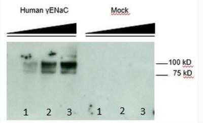 Western Blot: epithelial Sodium Channel gamma Antibody (3c7)BSA Free [NBP2-41371]