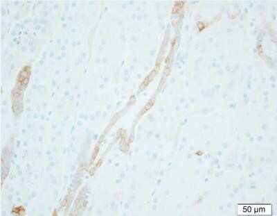 Immunohistochemistry-Paraffin: epithelial Sodium Channel gamma Antibody (5c2) - BSA Free [NBP2-41373]