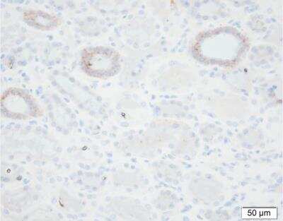 Immunohistochemistry-Paraffin: epithelial Sodium Channel gamma Antibody (11-35-1) - BSA Free [NBP2-41374]