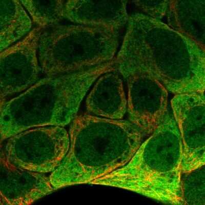 Immunocytochemistry/ Immunofluorescence: epithelial Sodium Channel gamma Antibody [NBP2-56532]