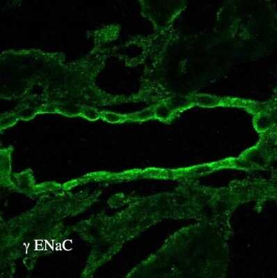 Immunohistochemistry: epithelial Sodium Channel gamma Antibody [NBP3-18256]