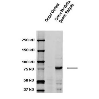 Western Blot: epithelial Sodium Channel gamma Antibody [NBP3-18256]