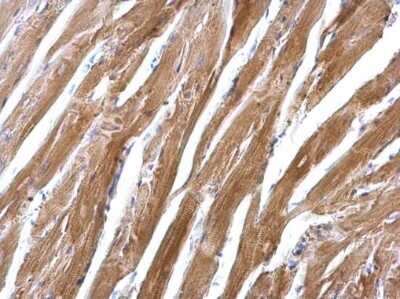 Immunohistochemistry-Paraffin: epsilon-Sarcoglycan Antibody [NBP2-20335]