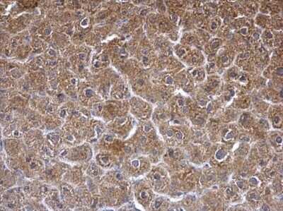 Immunohistochemistry-Paraffin: epsilon-Sarcoglycan Antibody [NBP2-20335]