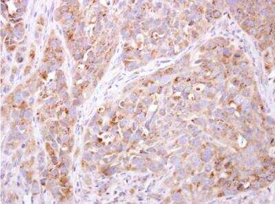 Immunohistochemistry-Paraffin: ethanolamine kinase Antibody [NBP1-31606]
