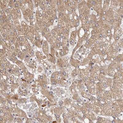 Immunohistochemistry-Paraffin: ethanolamine kinase Antibody [NBP2-33918]