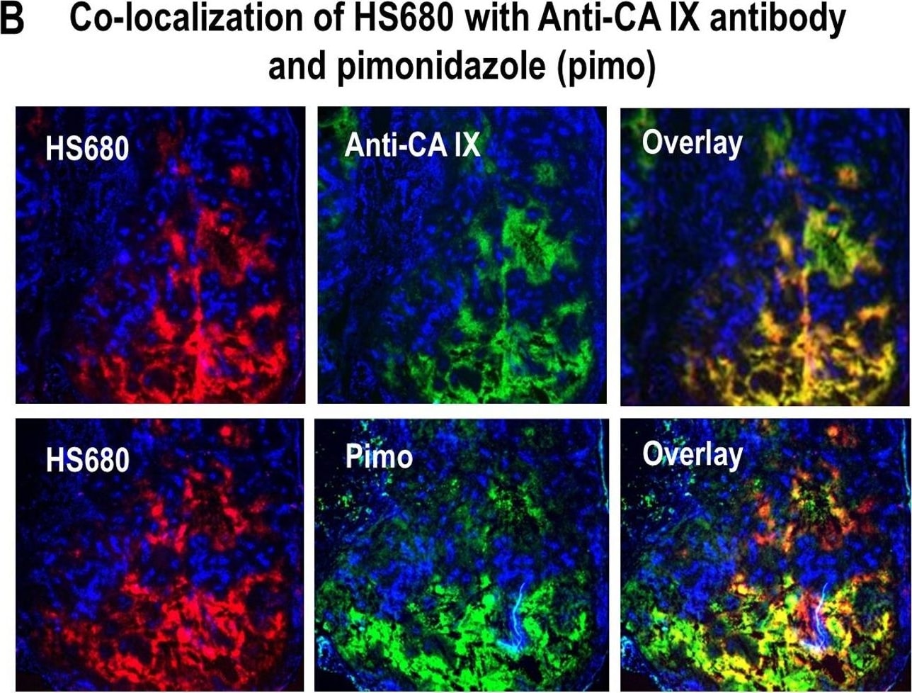 Detection of Carbonic Anhydrase IX/CA9 by Immunohistochemistry