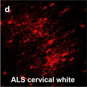 Detection of Human Hemoglobin by Immunohistochemistry