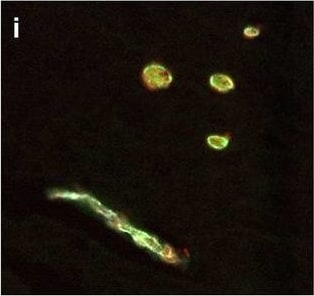 Detection of Human Hemoglobin by Immunohistochemistry