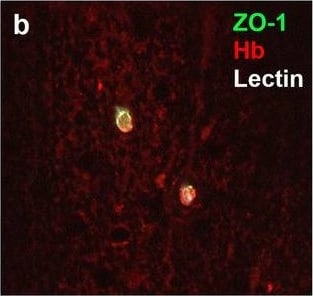 Detection of Human Hemoglobin by Immunohistochemistry