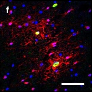 Detection of Human Hemoglobin by Immunohistochemistry