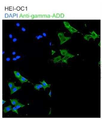 Immunocytochemistry/ Immunofluorescence: gamma Adducin Antibody [NBP1-79783]