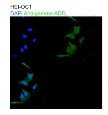 Immunocytochemistry/ Immunofluorescence: gamma Adducin Antibody [NBP1-79784]
