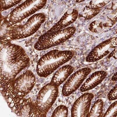 Immunohistochemistry: gamma Adducin Antibody [NBP2-34017]