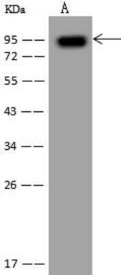 Western Blot: gamma Adducin Antibody [NBP3-12551]