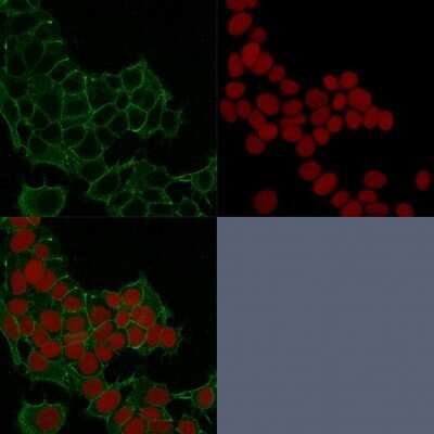 Immunocytochemistry/ Immunofluorescence: gamma Catenin Antibody ([11E4]) - Azide and BSA Free [NBP2-54528]